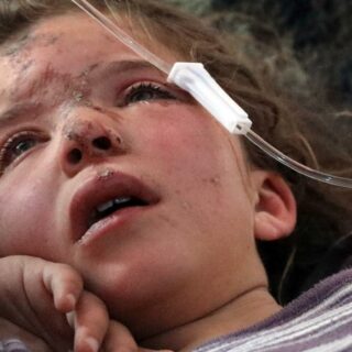 Jana al-Abdo, a seven-year-old Syrian child, receives treatment at a hospital in Idlib, Syria, on 8 February 2023 (foto: AP).