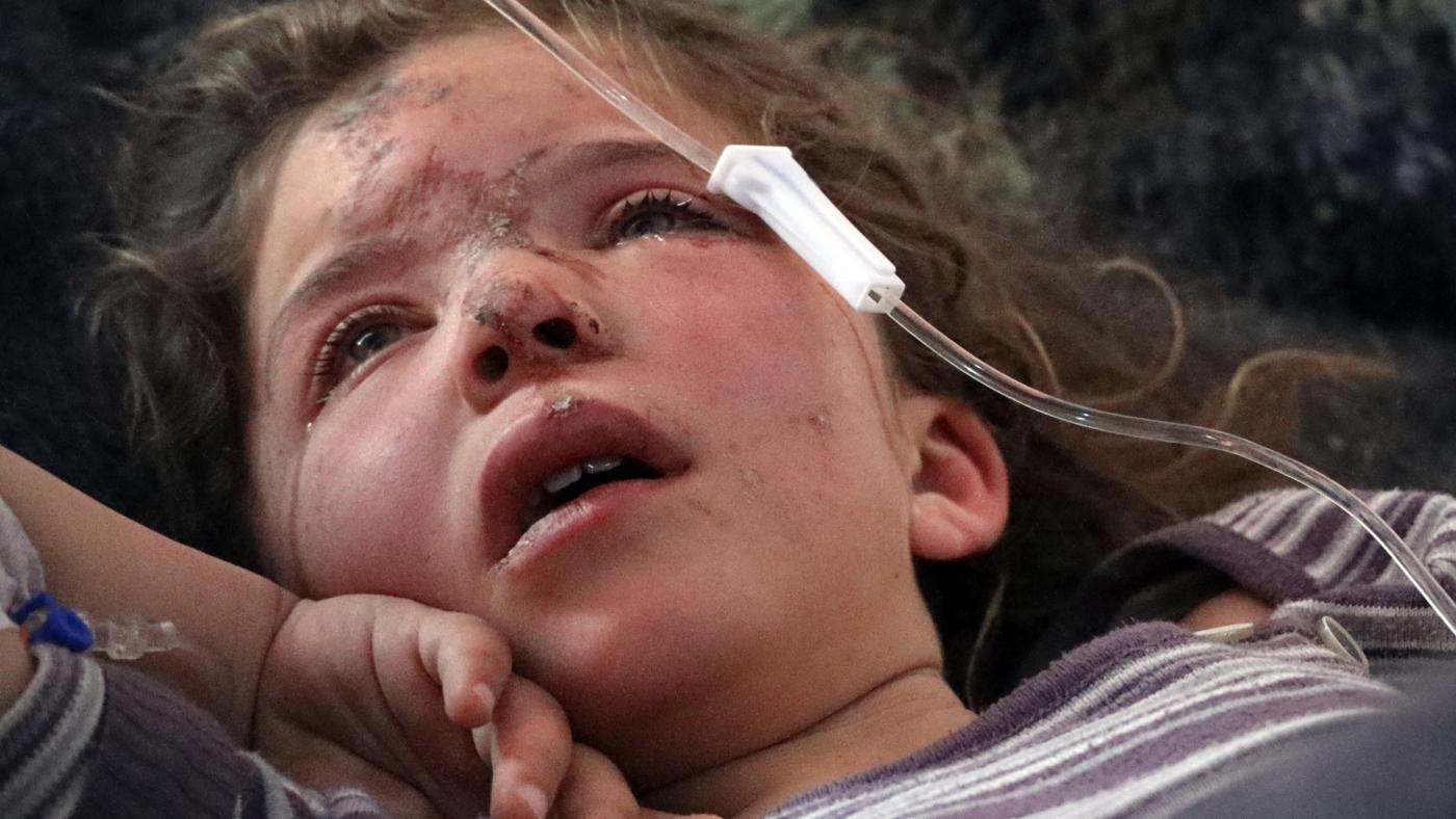 Jana al-Abdo, a seven-year-old Syrian child, receives treatment at a hospital in Idlib, Syria, on 8 February 2023 (foto: AP).